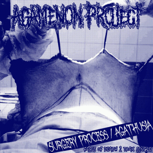 Agamenon Project : Surgery Process - Agathusia